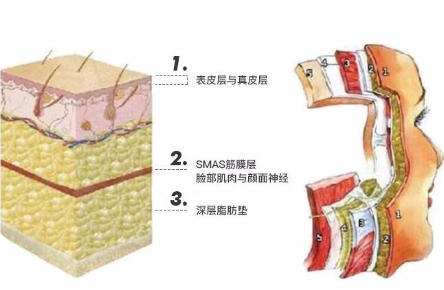 埋线面部提升可以持续的时间