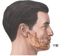 下颌角切除费用是多少呢？价格和哪些影响因素有关？