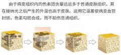 激光洗眼线方法科普！多久能恢复？注意事项教给你，记得收藏！