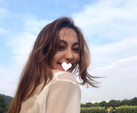 上海氧颜医疗双眼皮案例分享