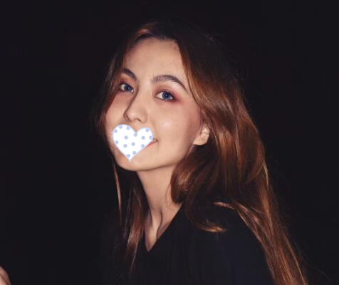 上海氧颜医疗双眼皮案例分享