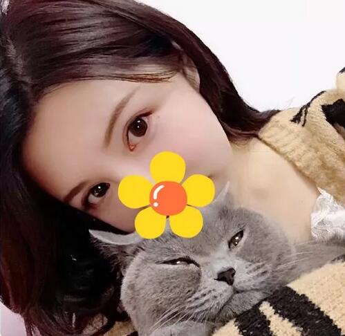 上海珂莱娅整形医院双眼皮案例分享