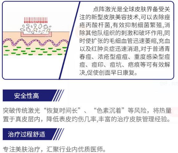 非剥脱性点阵激光