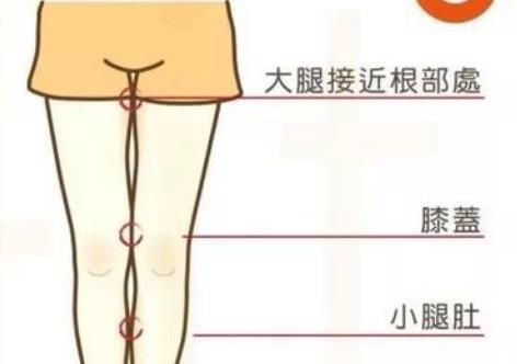 大腿吸脂