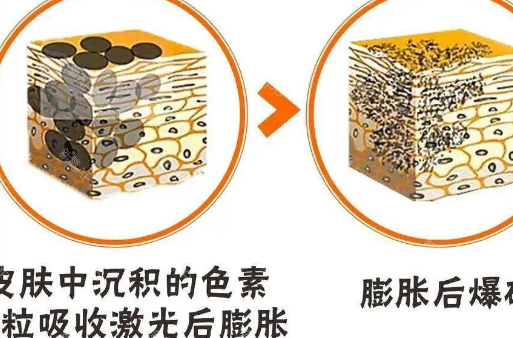 沈阳七院激光祛斑怎么样？价格多少？公布相关信息！附案例