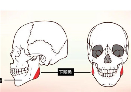 颧骨提升术有风险吗?会失败吗