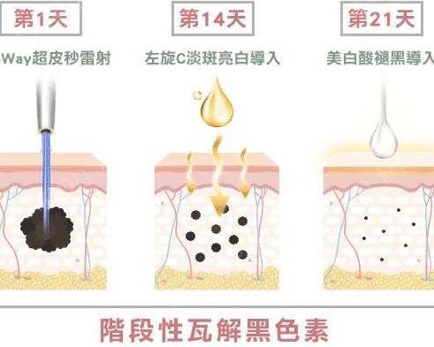 皮秒激光的作用和风险有哪些