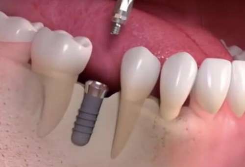 云南省老年病医院口腔科怎么样？靠谱医生、特色项目一一揭晓了