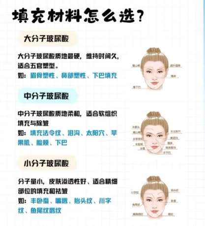 面部填充科普hh01.jpg