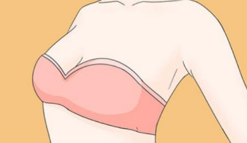 内窥镜隆胸恢复期要多久？各阶段的恢复情况和注意事项