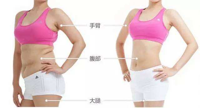 王洪医生科普腰腹吸脂手术