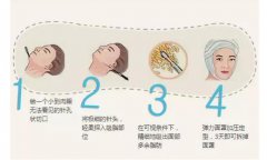 面颊吸脂是吸哪里?价格是多少?不听话的肉肉这样处理,魅力加分!