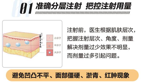 透明质酸注射除皱