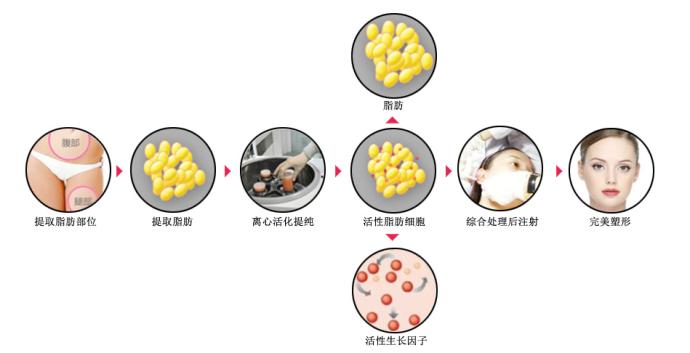 北京国济中医院科普面部填充