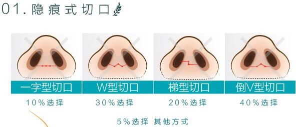 南宁华美林勇医生科普隆鼻手术