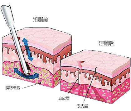 健康减肥的方法