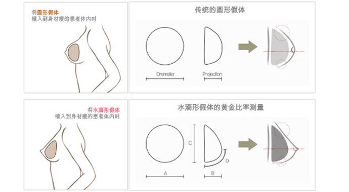 北京八大处整容医院科普隆胸​手术