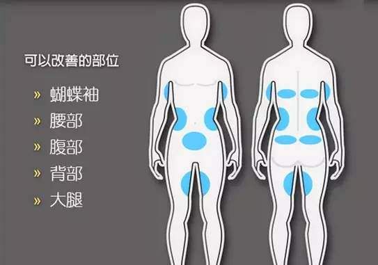 深圳鹏程整形医院科普吸脂手术