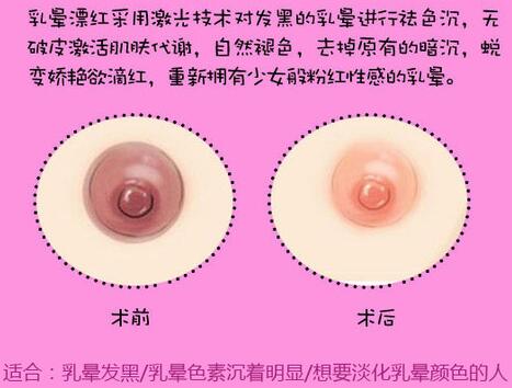 怎样使乳晕变红