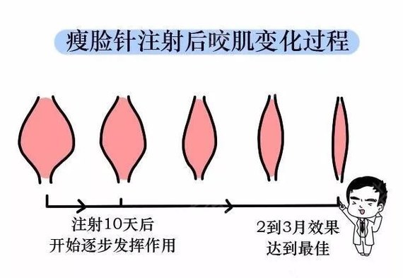 手术后常见问题有什么?