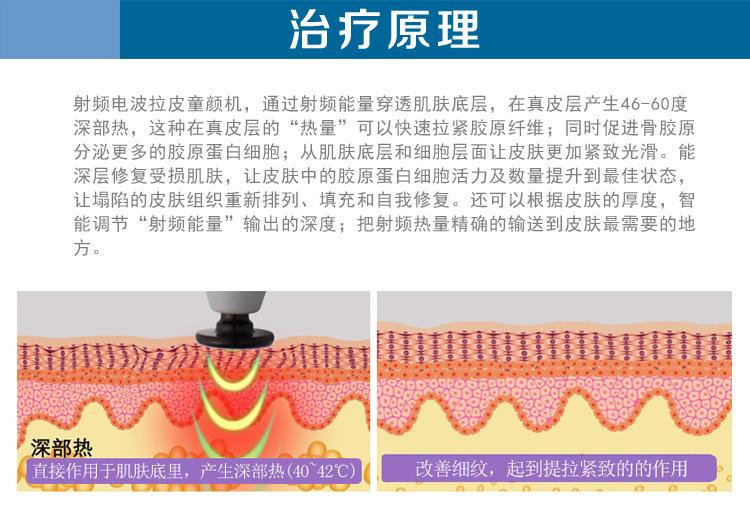 电波拉皮果怎么样