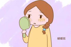 蝴蝶斑怎么治较有？形成原因了解一下，净斑攻略分享！