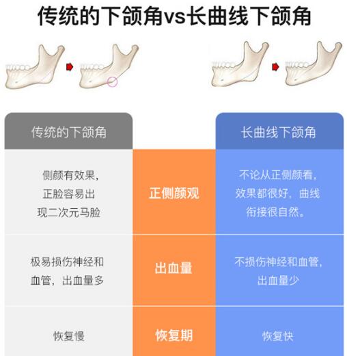 下颌角切除手术