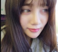 打完水光补水恢复期图片分享！附上真实案例分享！快来看看吧