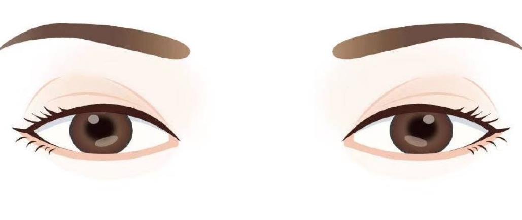 双眼皮