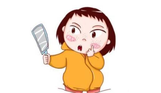 如何祛除脸上斑点？激光调节、药物调节等果都很不错！