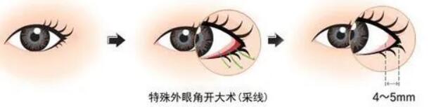 开外眼角动漫04.jpg
