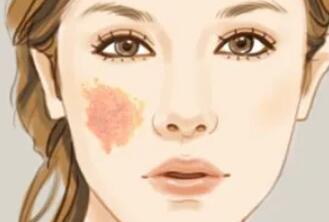 去胎记动漫03.jpg 去胎记动漫03.jpg