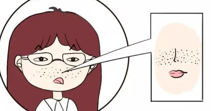 皮肤干燥粗糙怎么办？方法及注意事项公布！快来体验变美吧