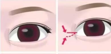 开眼角动漫4.jpg