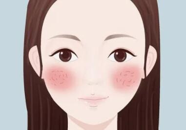 调节脸上红血丝真人案例分享！轻松和红脸蛋说拜拜！