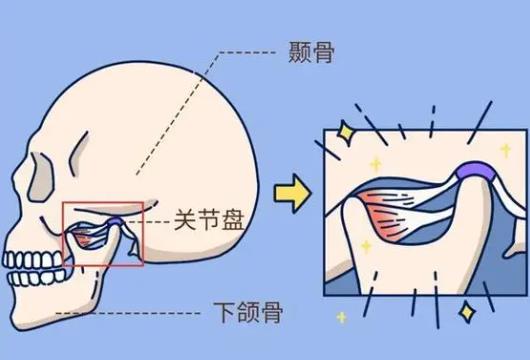 下颌角不对称04.jpg