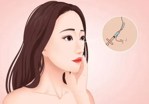 塌鼻子整形多少钱？术前术后注意事项有哪些？做者必看！