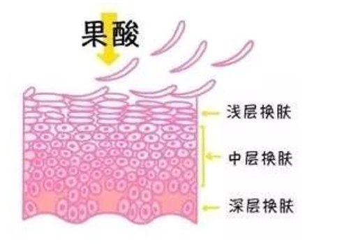 果酸调节黄褐斑几次能调节好？快来看详细科普介绍吧