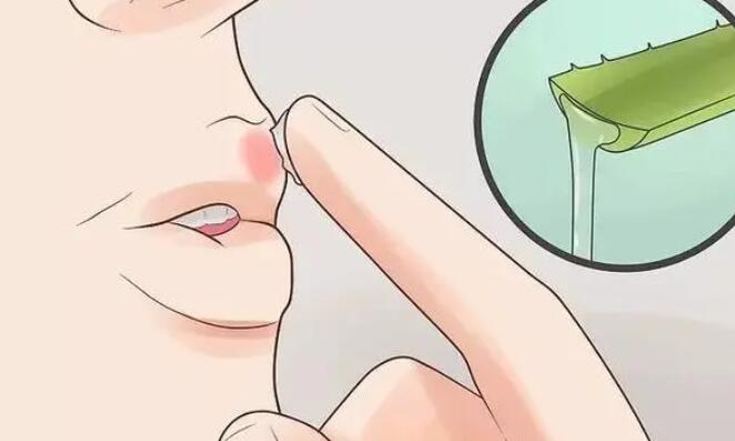上火嘴唇起泡怎么办怎么快速消除？药物调节、饮食调整果都不错！