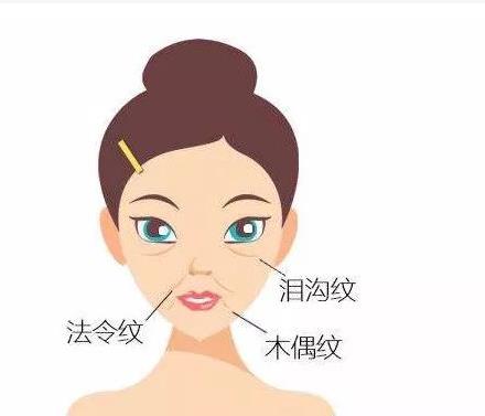 北京联合丽格杨大平做拉皮怎么样？拉皮效果好不好？附手术案例分享