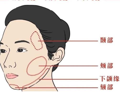 颧骨提升术有效吗?颧骨提升效果明显吗