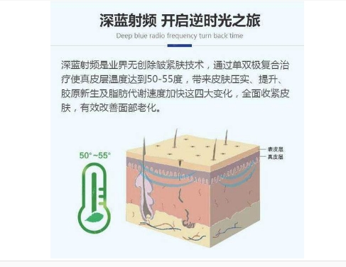 什么是射频紧肤?有什么优点