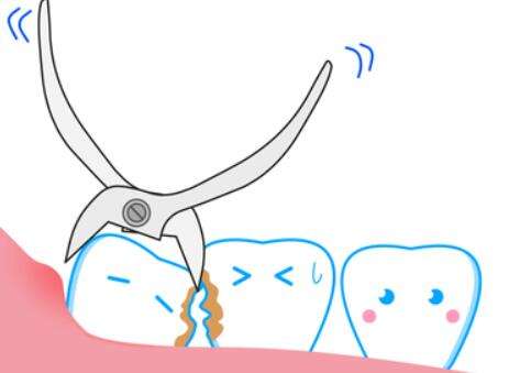 智齿拔掉的利与弊是什么？戳进来看看利与弊的介绍