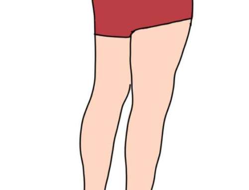 无痛瘦腿吸脂术前后对比图怎么样？秒变漫画腿的秘密这有