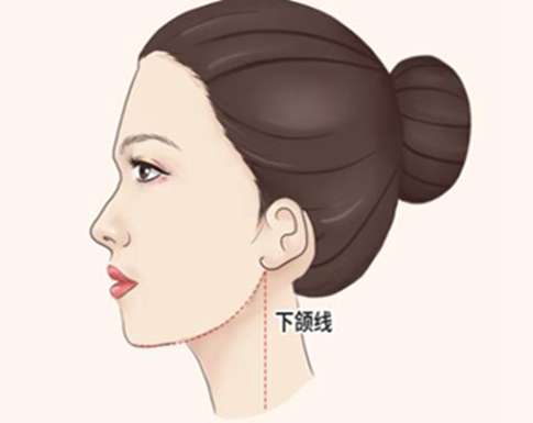 下颌缘提升适合多大年龄去做？速看详细年龄一览，医美党必存