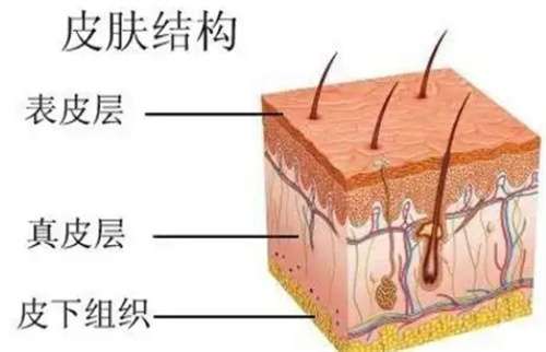 AOPT超光子嫩肤单模式?AOPT超光子嫩肤术后疼痛严重吗?