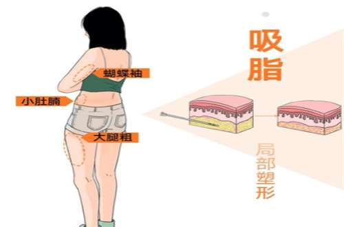 阜阳微悦医疗美容医院吸脂技术怎么样？基本信息已经阐述