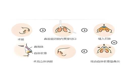 上海瑰康医疗美容医院怎么样？看技术与价格优势
