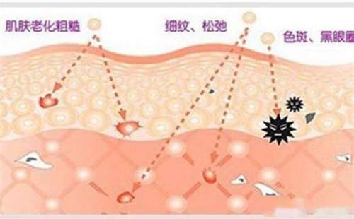 徐州点阵激光多少钱一次怎么样?医院实力曝光