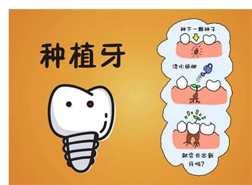 假牙和种植牙哪个好点？种植牙有风险吗？  